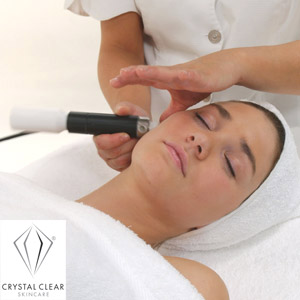 microdermabrasion